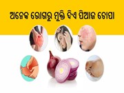 ଫୋପାଡନ୍ତୁ ନାହିଁ ପିଆଜ ଚୋପା, ଯନ୍ତ୍ରଣା ଭଳି ବଡ ବଡ ରୋଗରୁ ଦିଏ ମୁକ୍ତି 