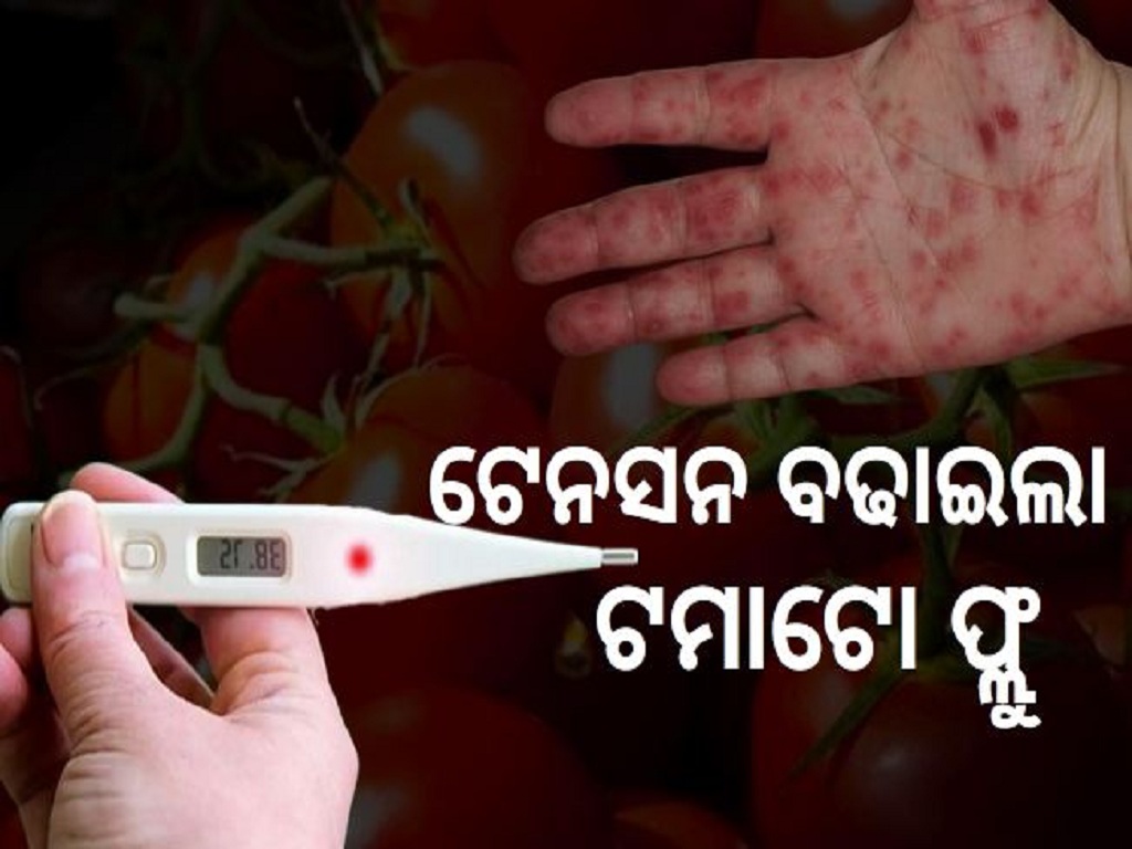 Alert in Karnataka over ‘tomato flu’