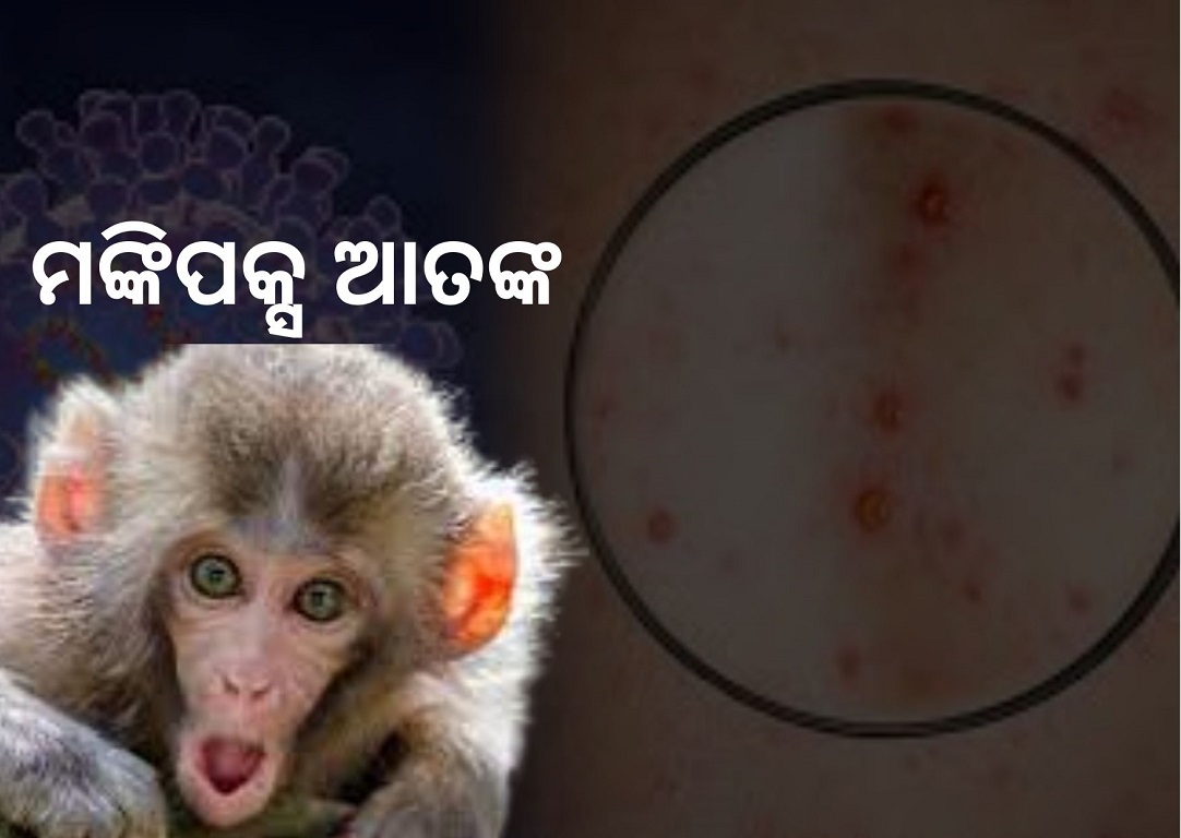 Second monkeypox case confirmed in Kerala