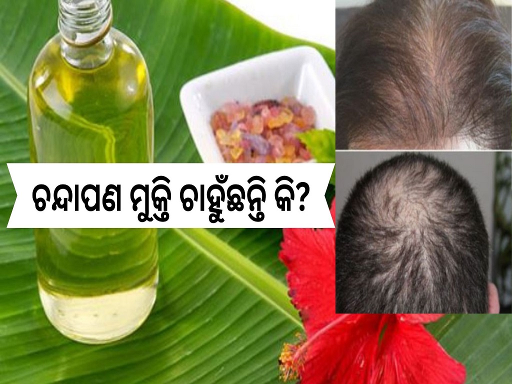 Hair loss Symptoms and causes