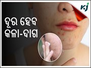 କଳା ଦାଗ କୁ ନେଇ ଚିନ୍ତିତ କି ? ଆପଣାନ୍ତୁ ଏହି ଉପାୟ ........