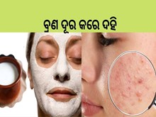 Skin Care Tips:ପ୍ରତିଦିନ ମୁହଁରେ ଲଗାନ୍ତୁ ଦହି, ପିମ୍ପଲ୍ ଓ ଟ୍ୟାନିଂ ଭଳି ସମସ୍ୟା ହେବ ଦୂର 