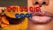 ଶୀତ ଦିନେ ହଳଦୀ ଦୂର କରିଦେବ ଓଠ ଫଟା ସମସ୍ୟା...