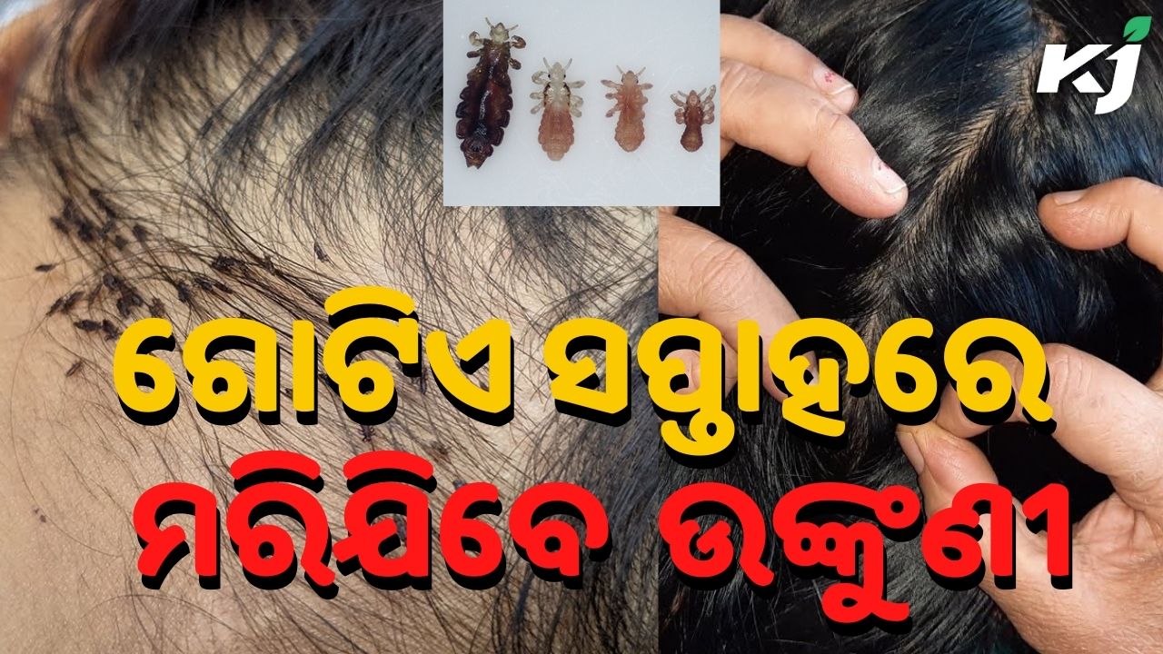 Effective Home Remedies to get rid of Head Louse