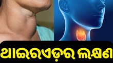 ଆପଣଙ୍କୁ ଥାଇରଏଡ଼ ହୋଇଛି କି ନାହିଁ ଜାଣିବେ କେମିତି ?