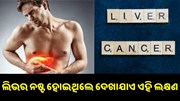 ଶରୀରରେ ଦେଖାଯାଉଛି କି ଏହି ୩ଟି ଲକ୍ଷଣ ? ତାହେଲେ ନଷ୍ଟ ହୋଇଯାଇଛି ଆପଣଙ୍କ ଲିଭର...