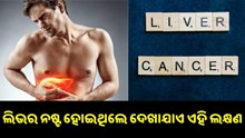 ଶରୀରରେ ଦେଖାଯାଉଛି କି ଏହି ୩ଟି ଲକ୍ଷଣ ? ତାହେଲେ ନଷ୍ଟ ହୋଇଯାଇଛି ଆପଣଙ୍କ ଲିଭର...