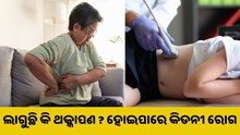 ଆପଣଙ୍କୁ ଦିନରେ ଲାଗୁଛି କି ଥକ୍କାପଣ ? ହୋଇପାରେ କିଡନୀ ରୋଗ..