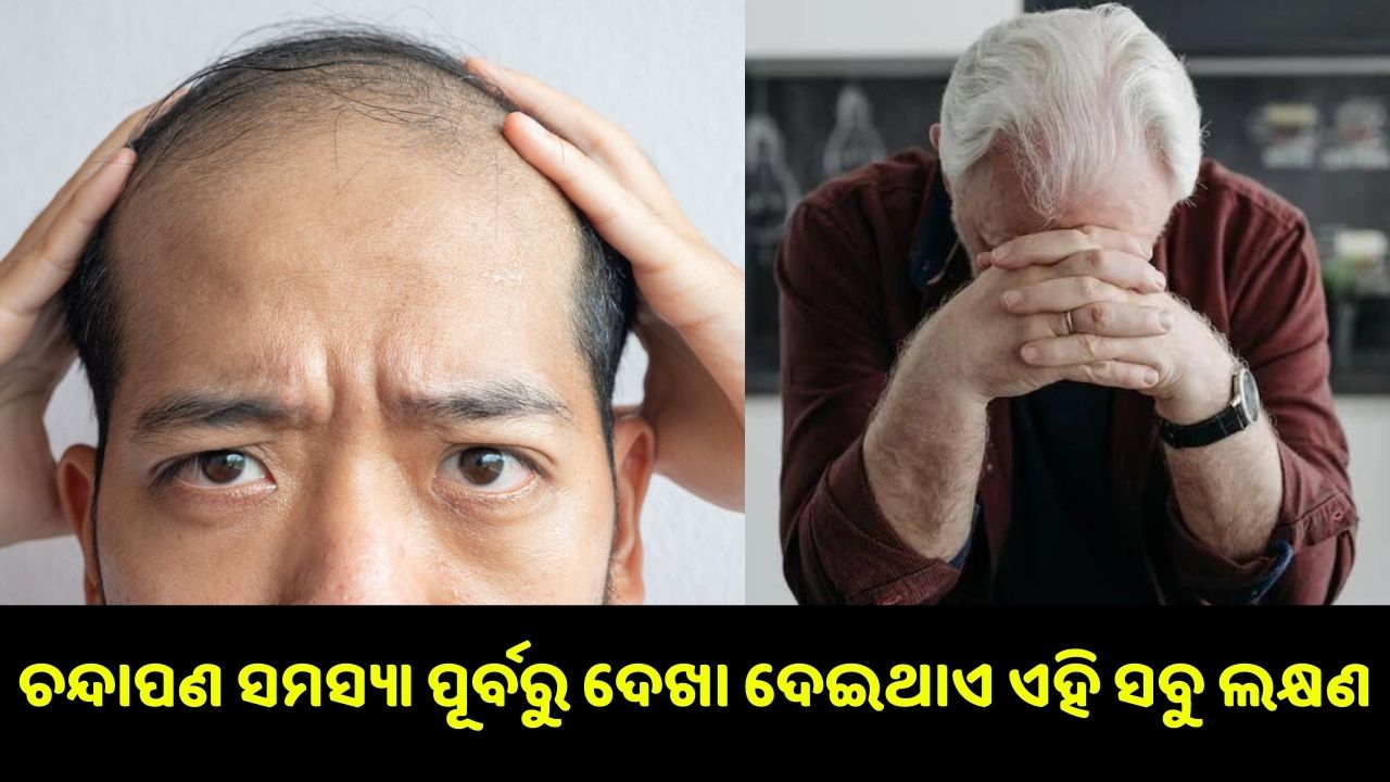 Why men face hair loss problems..pic credit: www.pexels.com
