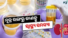 ମୂତ୍ର ରଙ୍ଗରୁ ଜାଣନ୍ତୁ ଆପଣଙ୍କ ରୋଗ 