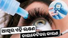 ଆଖିର ଏହି ଲକ୍ଷଣରୁ ଜାଣନ୍ତୁ ଡାଇବେଟିସ ହୋଇଛି କି ନାହିଁ ? 