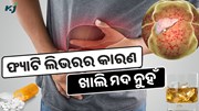 ଫ୍ୟାଟି ଲିଭରର କାରଣ ଖାଲି ମଦ ନୁହଁ, ଏହି ସବୁ ଖାଦ୍ୟରୁ ମଧ୍ୟ ହୋଇପାରେ ଫ୍ୟାଟି ଲିଭର