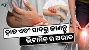 ହାତ ଏବଂ ପାଦରେ ଦେଖାଯାଉଛି କି ଏହି ଲକ୍ଷଣ ?ହୋଇପାରେ ଭିଟାମିନ୍ B12 ର ଅଭାବ