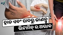 ହାତ ଏବଂ ପାଦରେ ଦେଖାଯାଉଛି କି ଏହି ଲକ୍ଷଣ ?ହୋଇପାରେ ଭିଟାମିନ୍ B12 ର ଅଭାବ