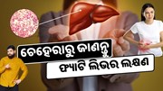 ଚେହେରାରୁ ଜାଣନ୍ତୁ liver ଠିକ ଅଛି କି ନାହିଁ, ତୁରନ୍ତ କରନ୍ତୁ ଏହି କାମ