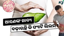 ଆପଣଙ୍କ ଦୈନନ୍ଦିନ ଖାଦ୍ୟ ବଢ଼ାଉଛି କି ଫ୍ୟାଟି ଲିଭର ସମସ୍ୟା, କରନ୍ତୁ ଏହି କାମ 