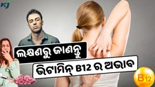 ଏହି ଲକ୍ଷଣରୁ ଜାଣନ୍ତୁ ହେଉଛି କି ଭିଟାମିନ୍ B12 ଅଭାବ ? କରନ୍ତୁ ଏହି କାମ 
