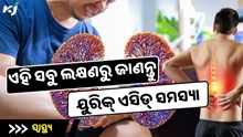  ୟୁରିକ୍ ଏସିଡ୍ ପୂର୍ବରୁ ଶରୀରରେ ଦେଖାଯାଏ ଏହି ସବୁ ଲକ୍ଷଣ, ହୋଇଯାଆନ୍ତୁ ସାବଧାନ 